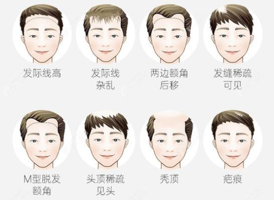 加拿大彩票官网